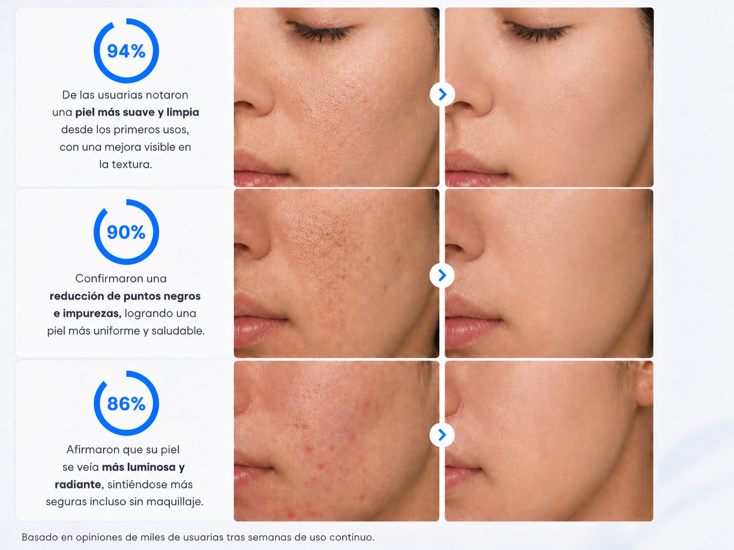 Personal Microderm Ultra™  — Envío Gratis + Oferta Activa